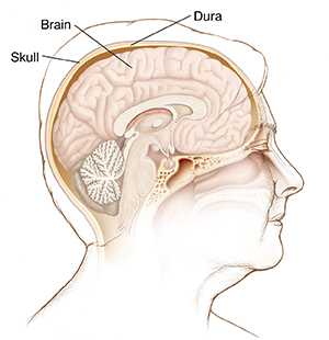 Side view of woman's head showing cross section of brain in skull.