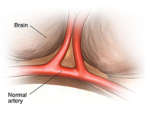 Closeup view of the brain showing normal arteries.