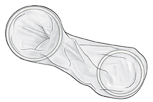Female condom.