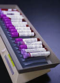 Picture of vials of blood, labeled
